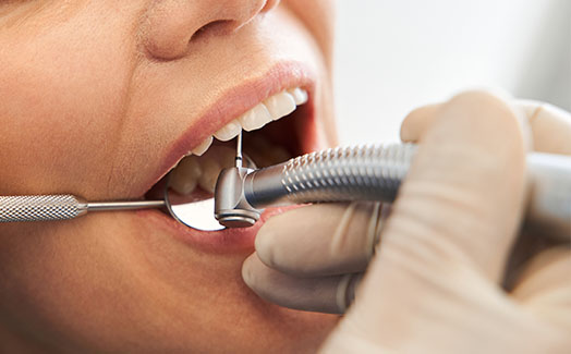 Close-up of dental procedure