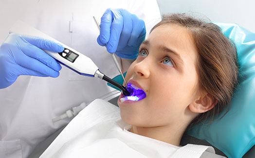 Girl undergoing dental sealant procedure